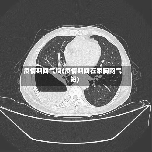 疫情期间气胸(疫情期间在家胸闷气短)-第3张图片